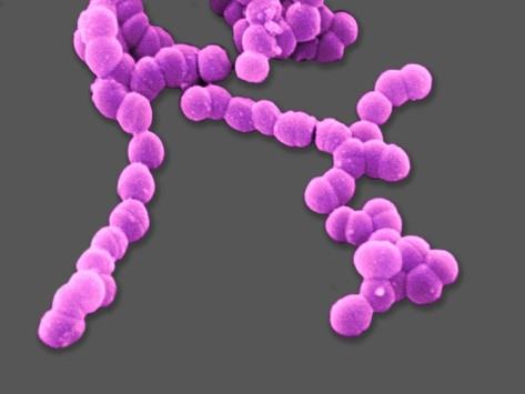 Streptococcus faecalis